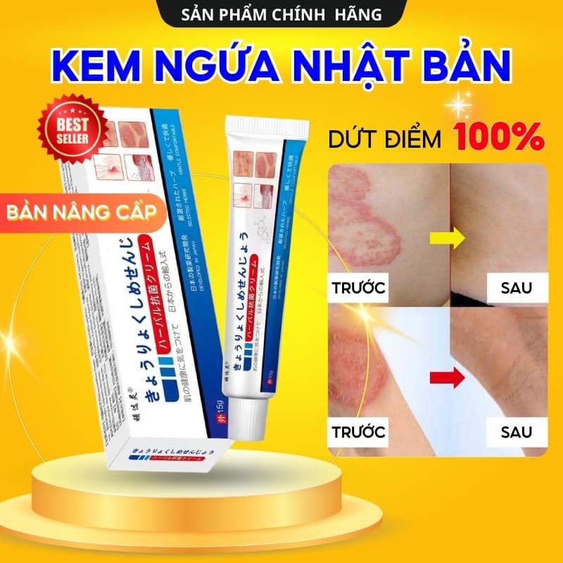 Kem Bôi Viêm Da Cơ Địa NHẬT BẢN Hỗ Trợ Dứt Điểm Lác Đồng Tiền, Nấm Da Đầu, Ghẻ Nước, Á Sừng Cực Kì Hiệu Quả